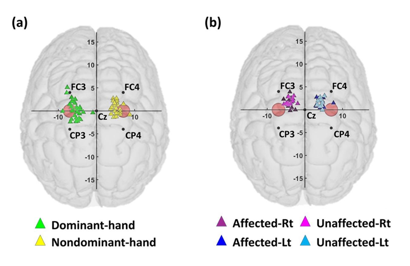 뇌전기자극 최적화 AI 기술